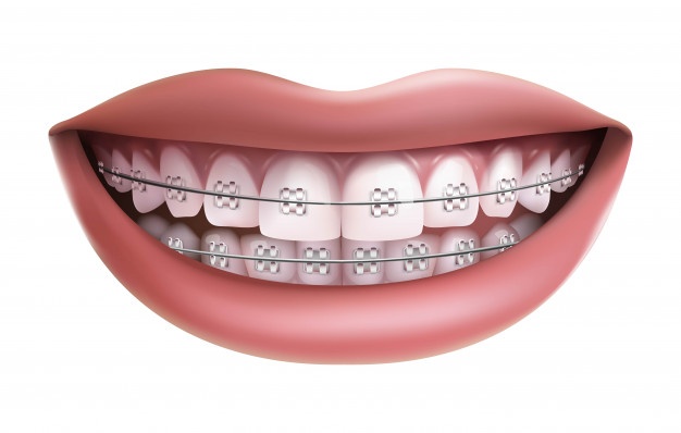牙齒矯正手術的一些常見危害的分析