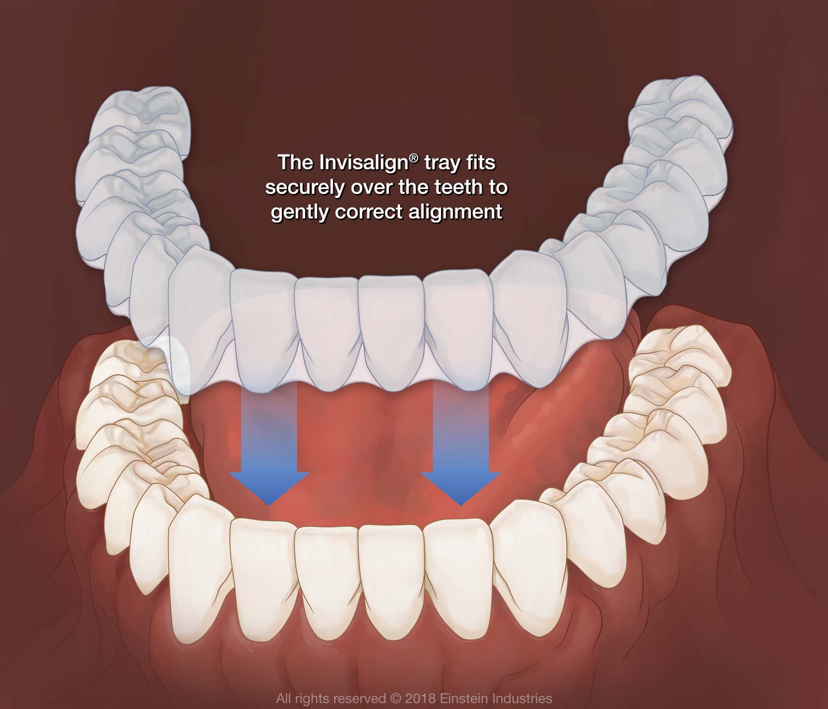 什麽是牙齒矯正 牙齒矯正的特點