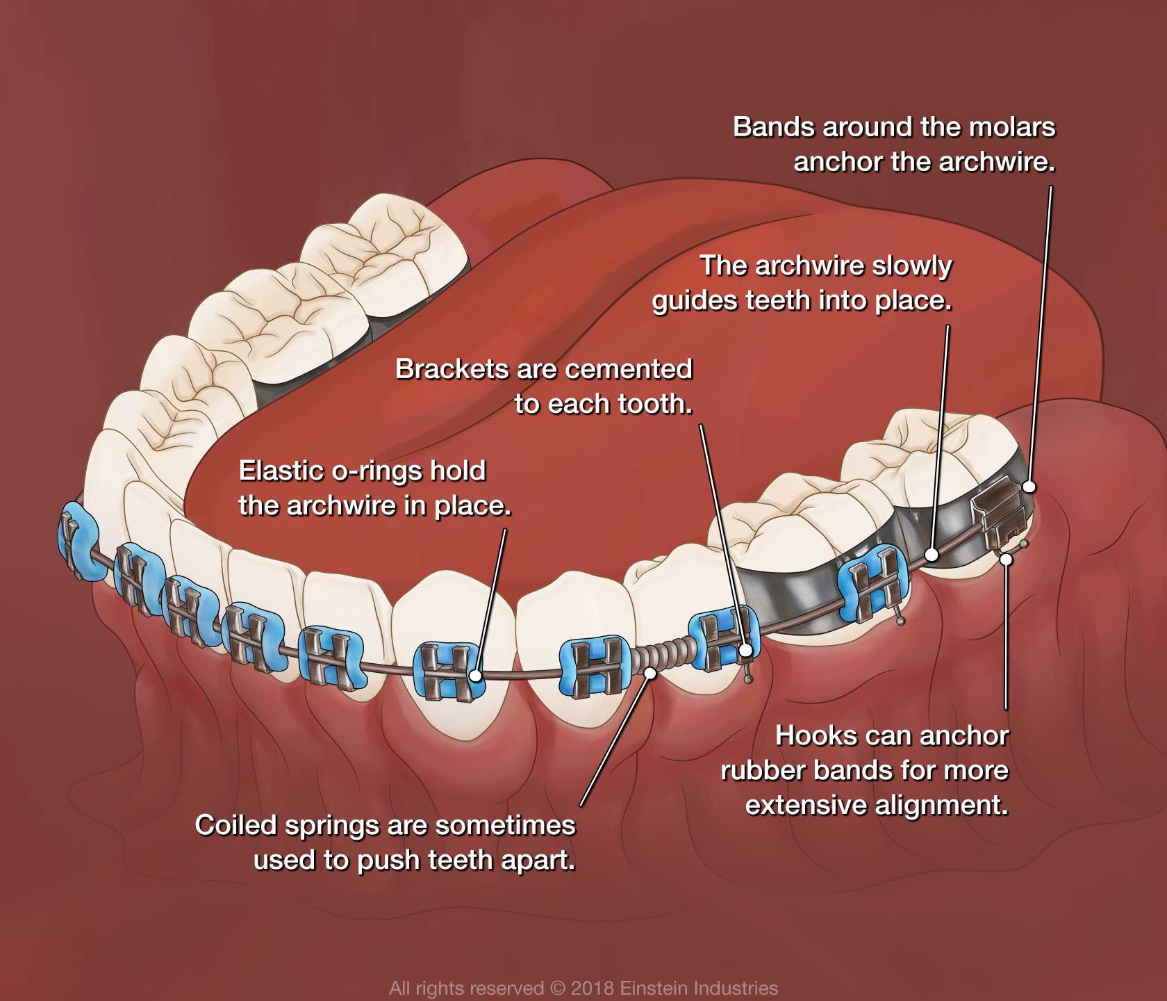 牙性和骨性龅牙怎麽治療？