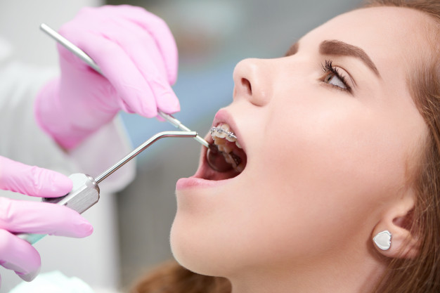 牙齒畸形大都是不良習慣導致