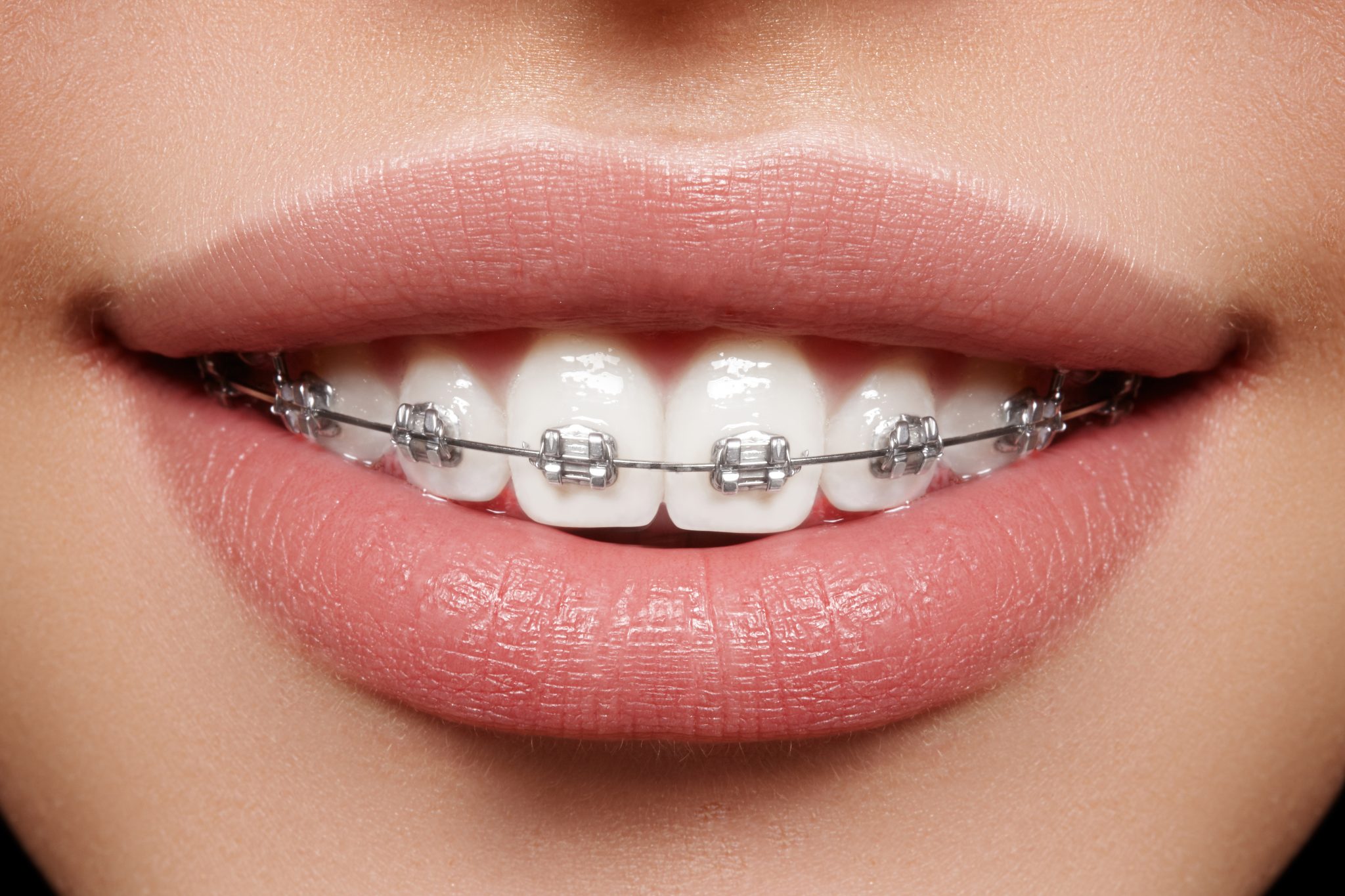 五種不良壞習慣易致牙颌畸形