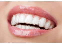 牙齒的矯正過程你知道嗎