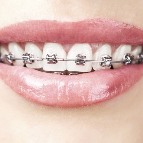 牙齒早期進行全面檢查的方法