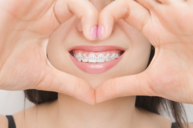 牙縫大除了影響顔值，還可能是牙病的信號！