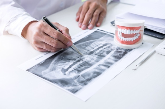 有效的牙齒矯正方法有哪些？