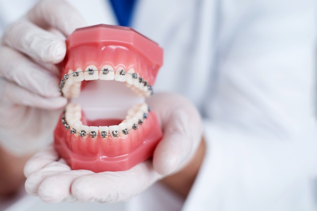 必須在12歲前處理的10種兒童牙颌畸形！