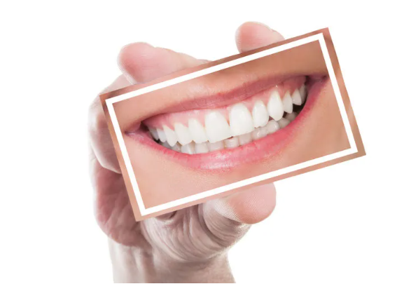 隱形箍牙像“塑料一樣的材質”，箍牙效果真的可以像鋼牙箍牙一樣好嗎？