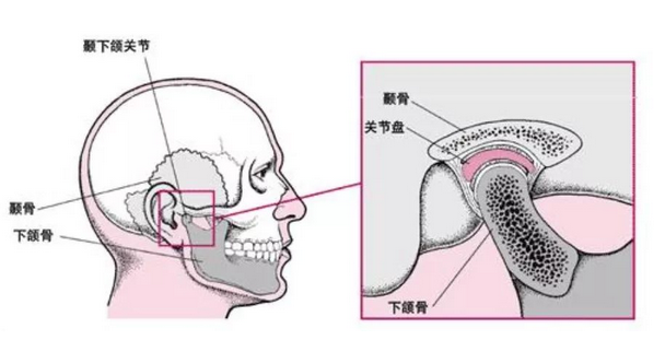 顳下頜關節紊亂