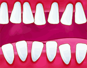 牙齒的“黑三角”有多可怕？可能還沒幾個人知道！