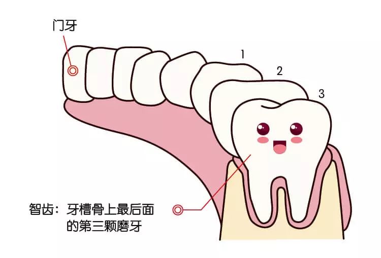 智齒出現這 6 種情況，疼不疼都得拔！否則...