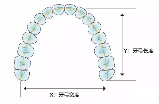 箍牙拔牙