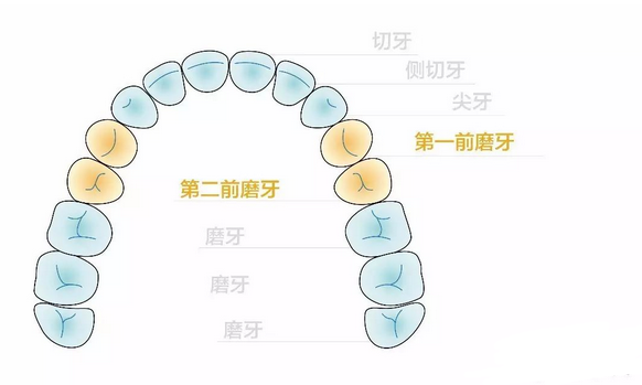 箍牙拔牙